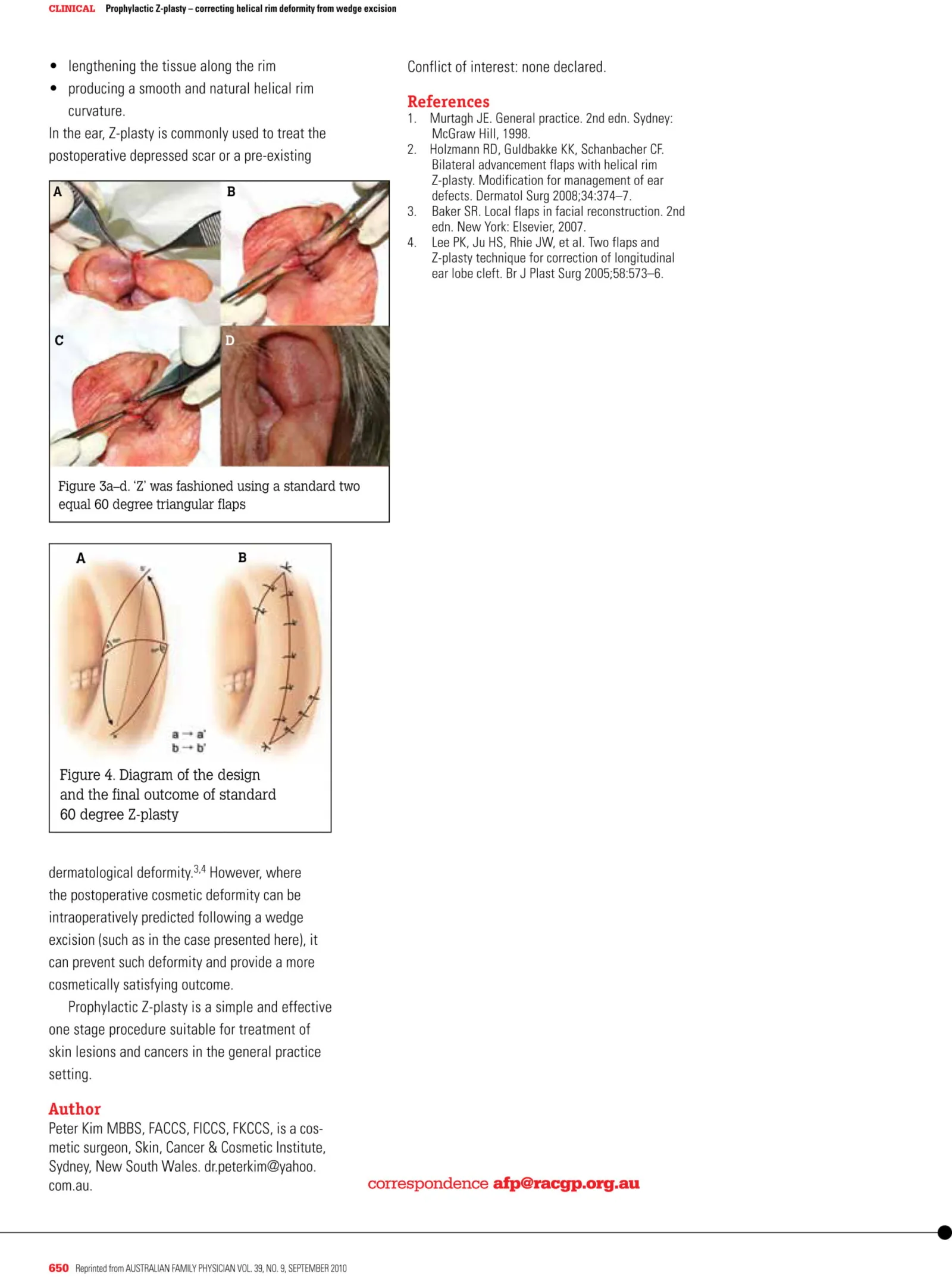 Page 2 of the prophylactic Z-plasty article with ear surgery photos and a diagram of a 60-degree Z-plasty
