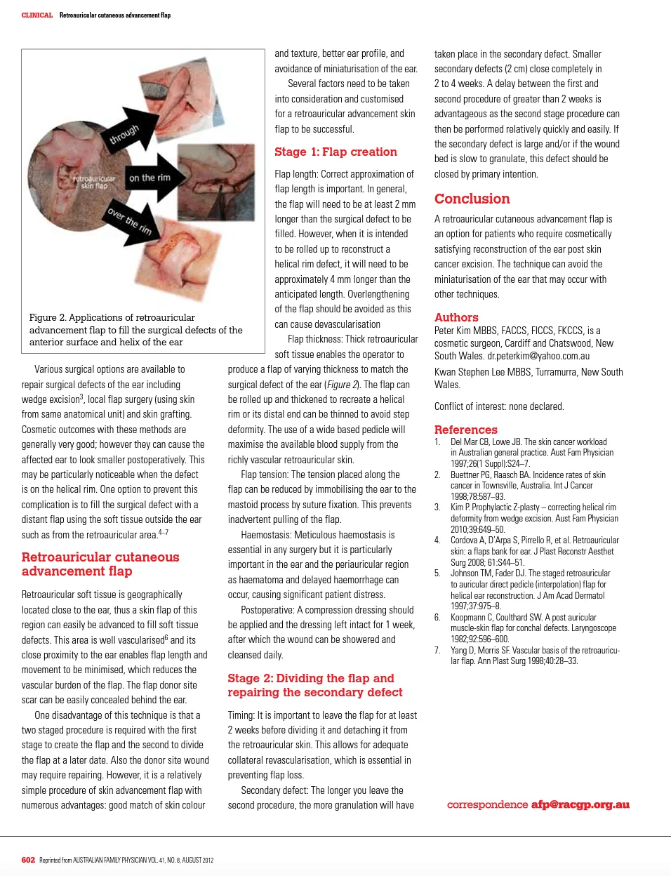 Page 2 of the retroauricular cutaneous advancement flap article describing flap creation and secondary defect repair